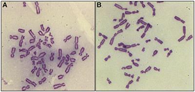 G2/M Checkpoint Abrogation With Selective Inhibitors Results in Increased Chromatid Breaks and Radiosensitization of 82-6 hTERT and RPE Human Cells